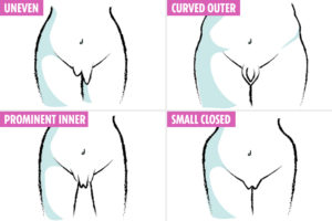 myths-about-the-vagina-debunked-different-vulvas